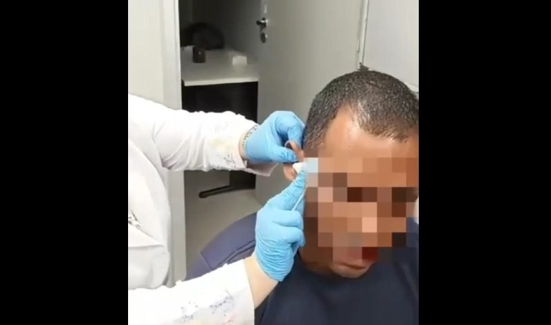 preso, concurso, ufpb, polícia federal, ponto eletrônico, fraude