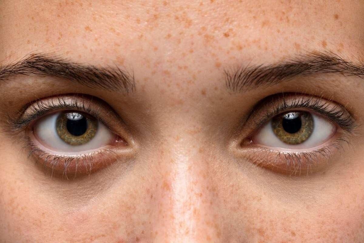 Olhos, Médicos, Alerta